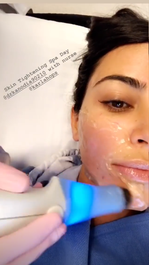 Kim Kardashian se quitó el maquillaje para mostrar su psoriasis